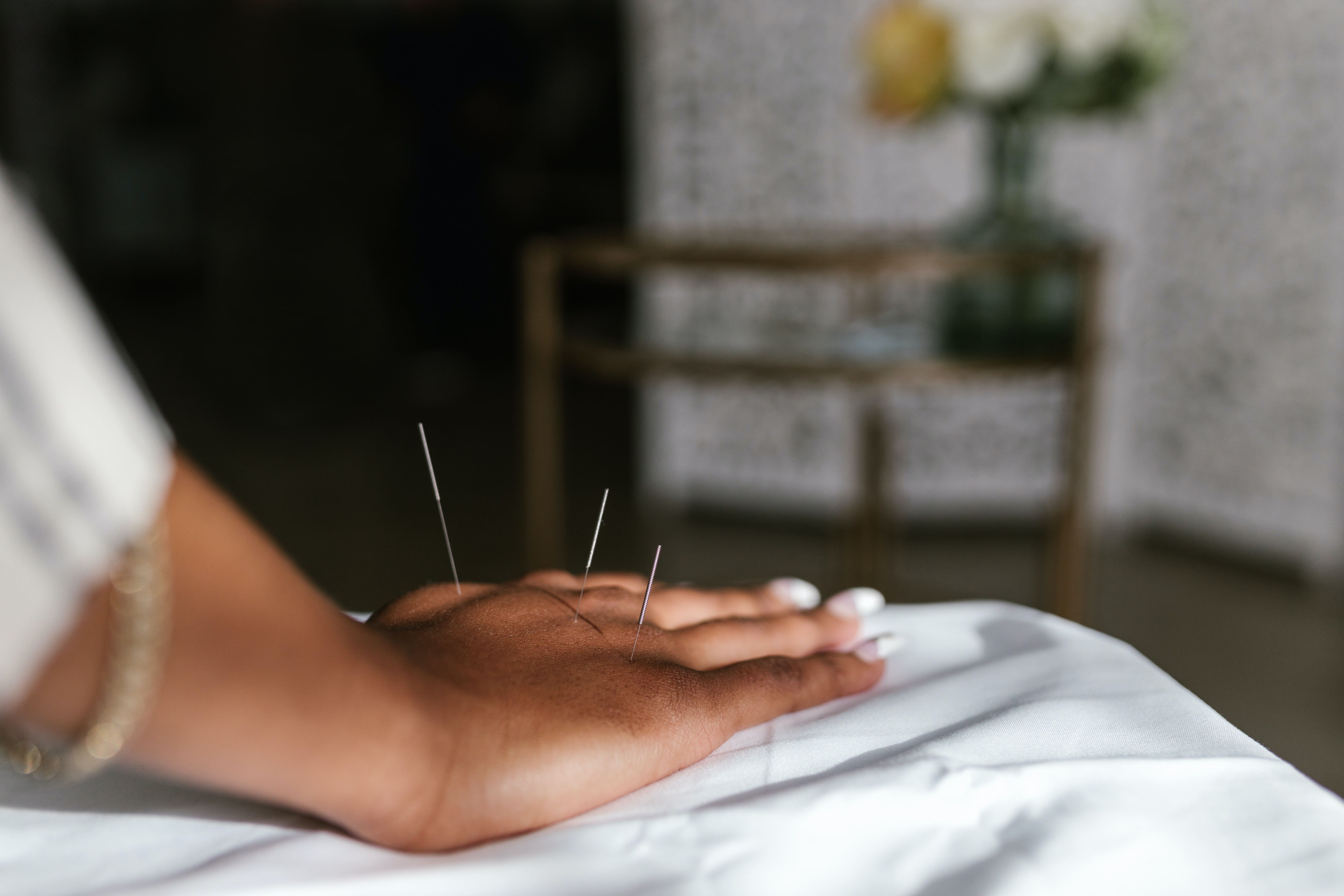 Acupuncture For Smoking